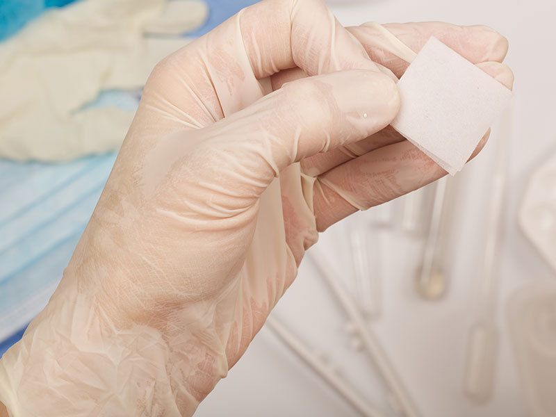 Surgical wounds
